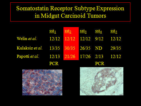 SST midgut tumors